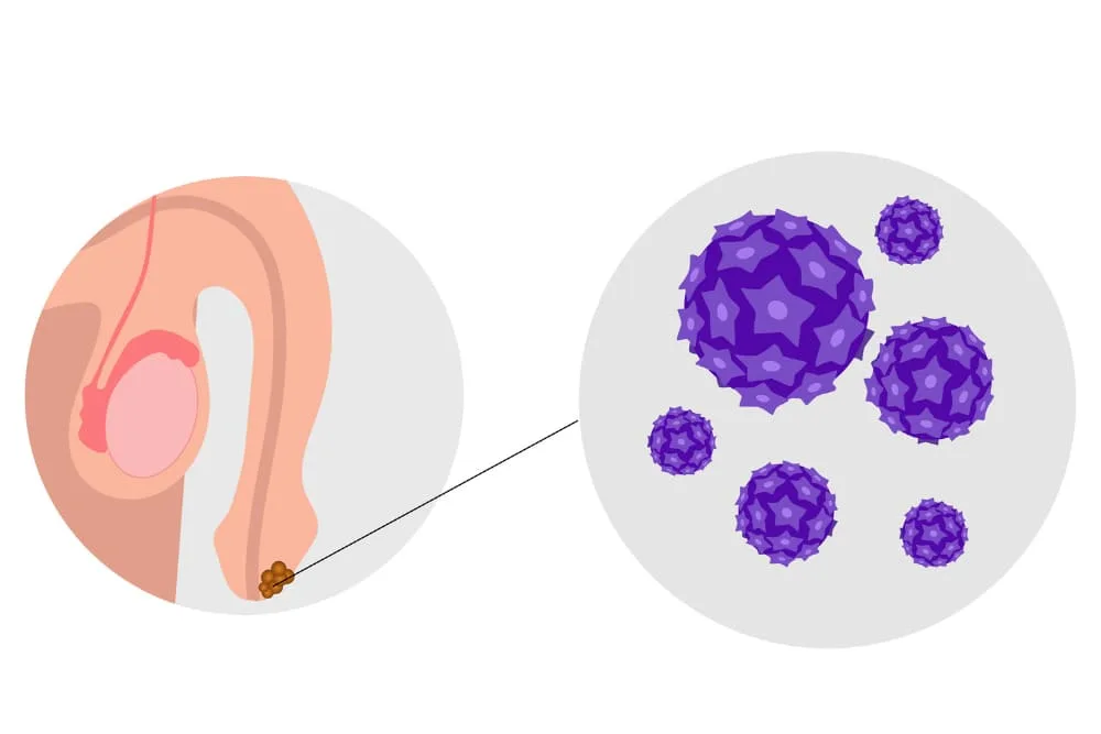 Atención especializada para infecciones genitales en CDMX